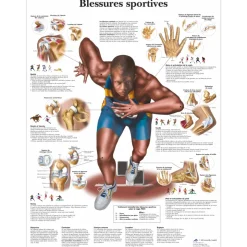 Planche anatomique 3B Scientific - Blessures sportives VR2188