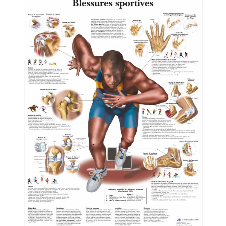 Planche anatomique 3B Scientific - Blessures sportives VR2188
