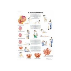 Planche anatomique - L'accouchement