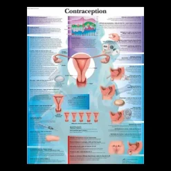 Planche anatomique - La contraception