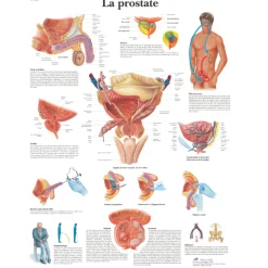 Planche anatomique - La Prostate