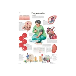 Planche anatomique - L'hypertension
