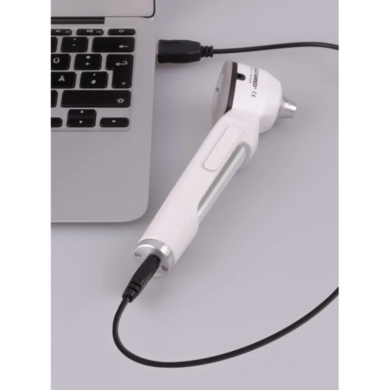 Set otoscope et ophtalmoscope LuxaScope Oculus LED 3.7 V