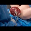 Simulateur d'accouchement Super OB Susie Erler Zimmer