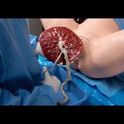 Simulateur d'accouchement Super OB Susie Erler Zimmer