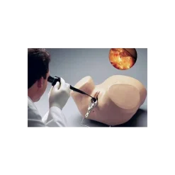 Simulateur d’Hystéroscopie Erler Zimmer