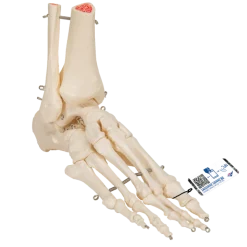 Squelette du pied avec moignon tibia et fibula (péroné) sur fil de fer 3B Scientific