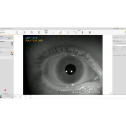Système de vidéonystagmoscopie Inventis VideoScope