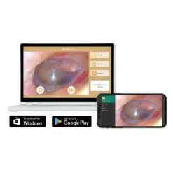 Videotoscope iO1 Elite SyncVision
