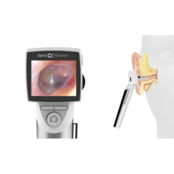 Videotoscope iO1 Elite SyncVision