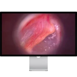 Vidéotoscope LED Firefly DE500 filaire