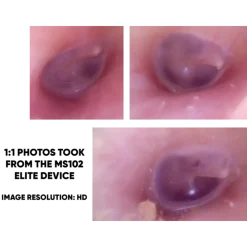 Vidéotoscope MD Scope MS102 HD - Pack Elite