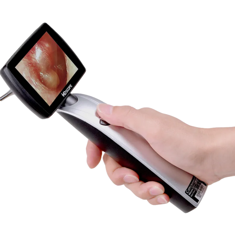 Vidéotoscope MD Scope MS102 - Pack Elite